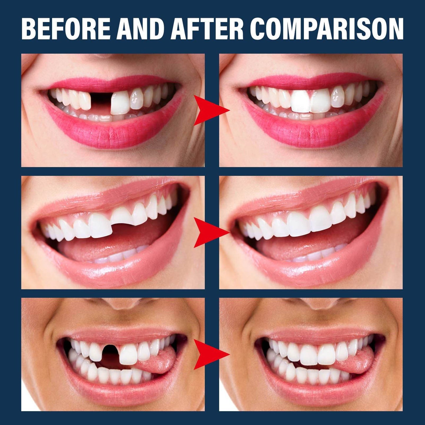 Denture Decorative Teether Set, Halloween Vampire Makeup Dress Up Fake Tooth Glue Teeth Props - www.Shopthatapp.com