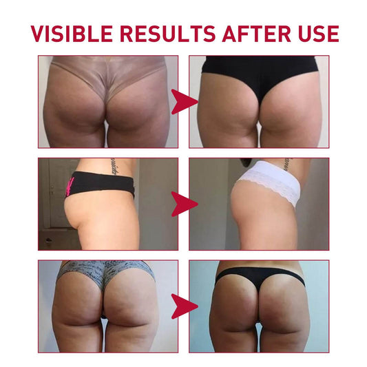 Plump Buttock Cream Lifts And Tightens Buttocks - www.Shopthatapp.com