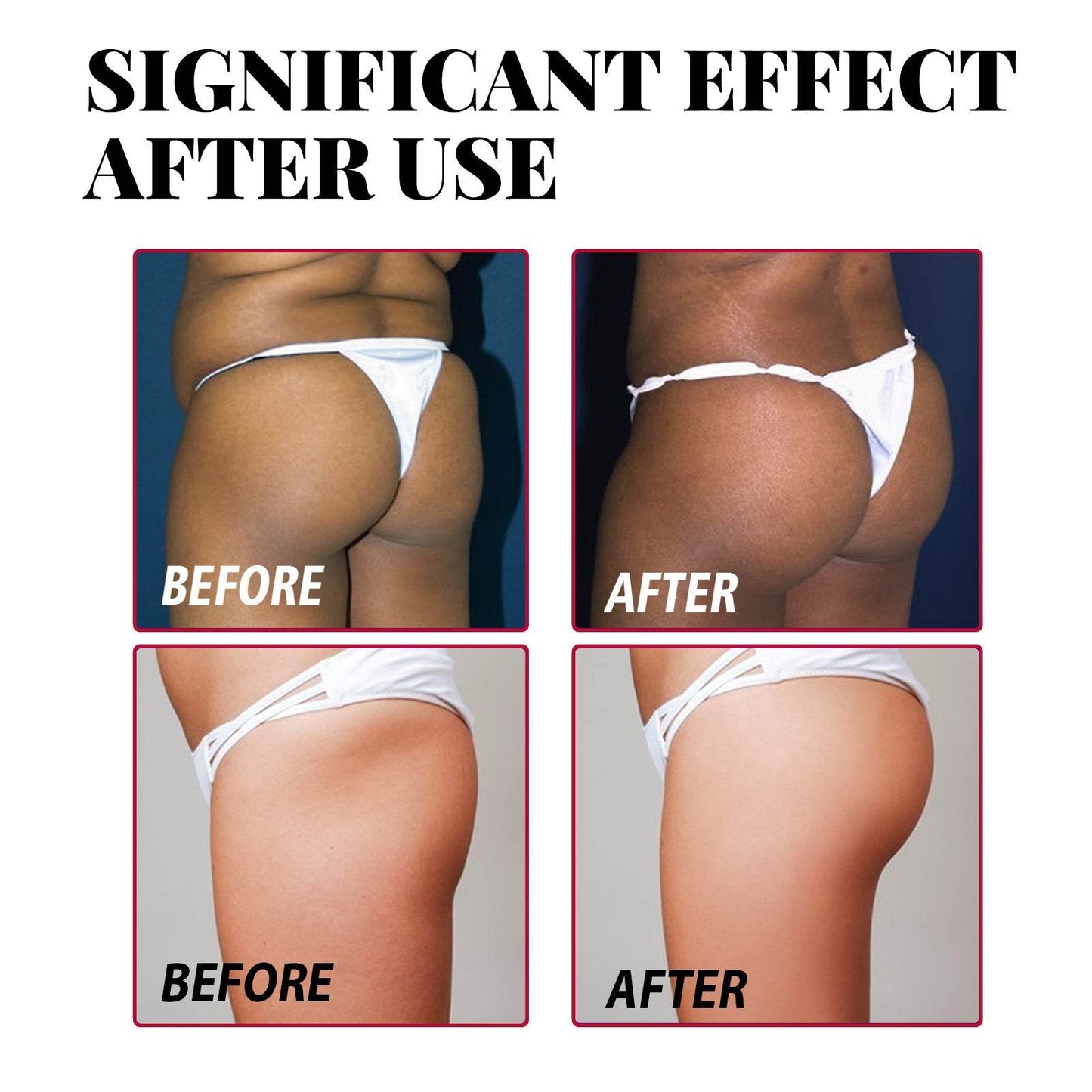 Plump Buttock Cream Lifts And Tightens Buttocks - www.Shopthatapp.com