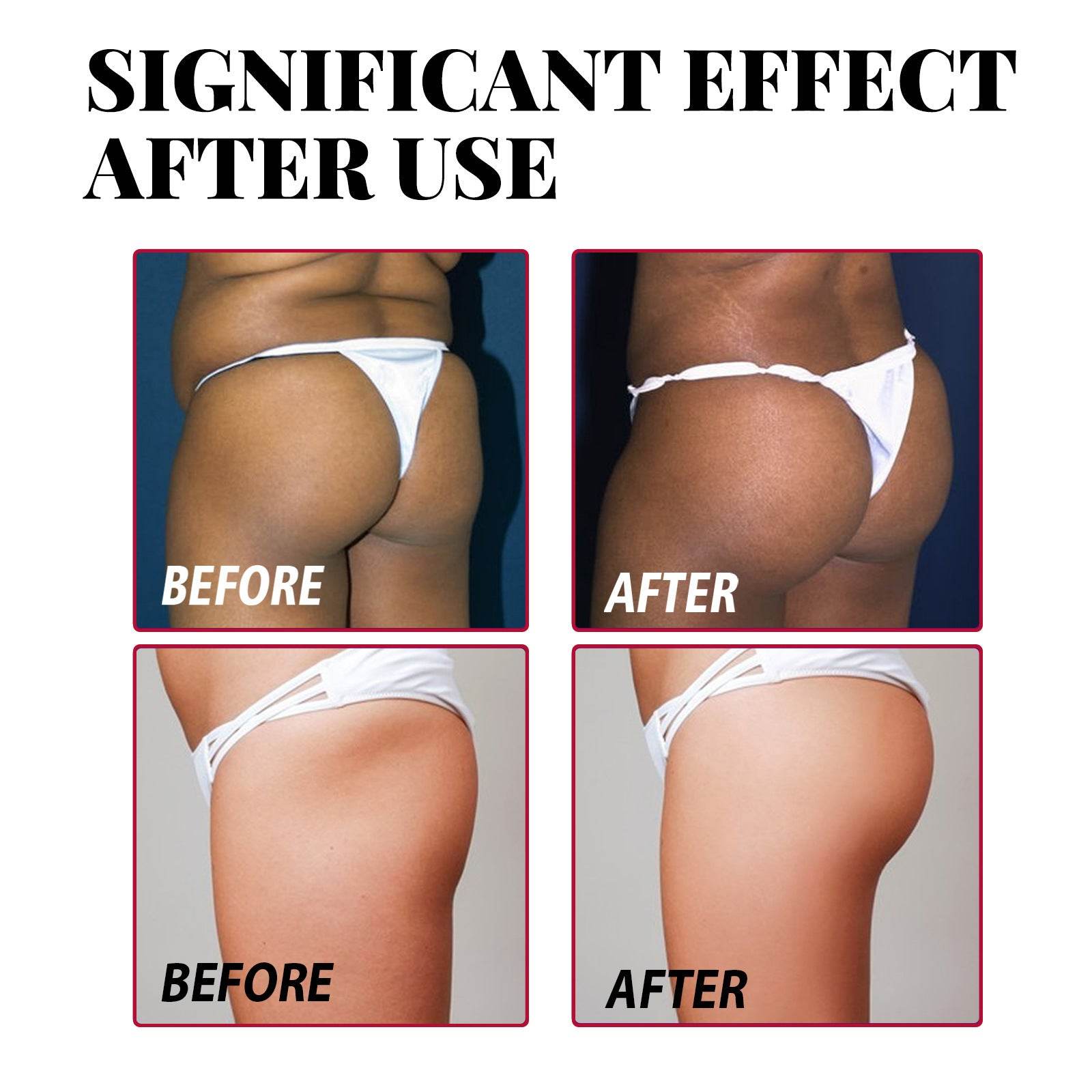 Plump Buttock Cream Lifts And Tightens Buttocks - www.Shopthatapp.com