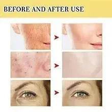 OUHOE Advanced Snail Mucin Power Essence Moisturizing Serum 100ml - www.Shopthatapp.com