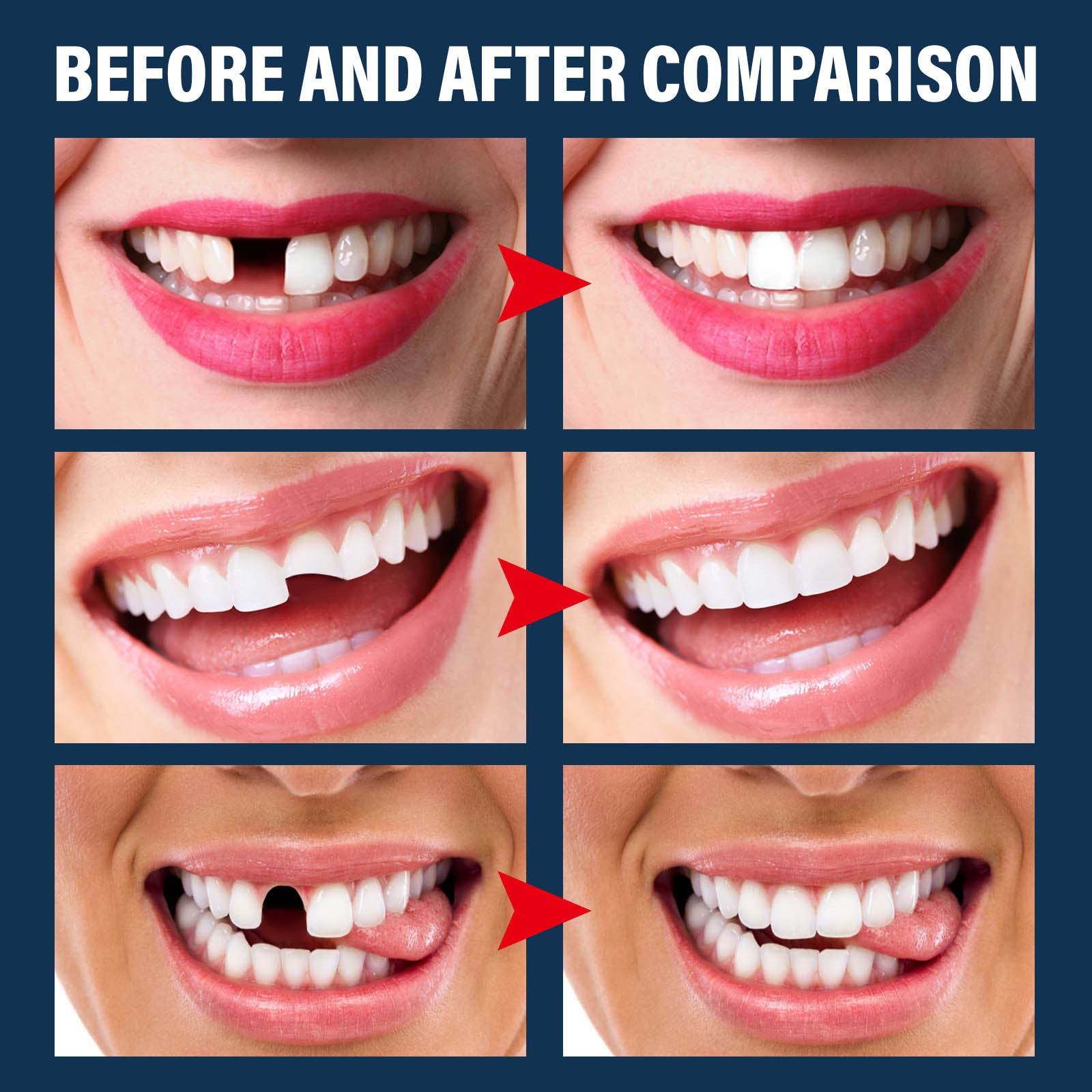 Denture Decorative Teether Set, Halloween Vampire Makeup Dress Up Fake Tooth Glue Teeth Props - www.Shopthatapp.com