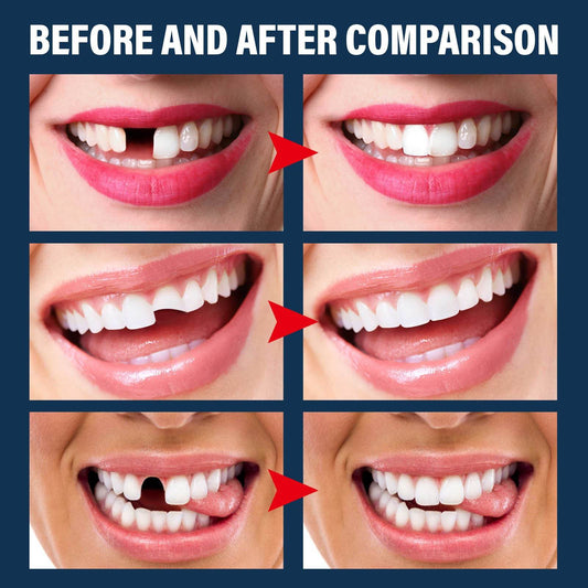 Denture Decorative Teether Set, Halloween Vampire Makeup Dress Up Fake Tooth Glue Teeth Props - www.Shopthatapp.com