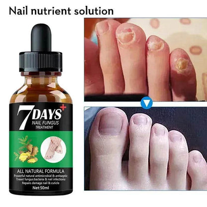 7DAYS Nail Fungus Treatment Serum Care Hand And Foot Care Removal - www.Shopthatapp.com