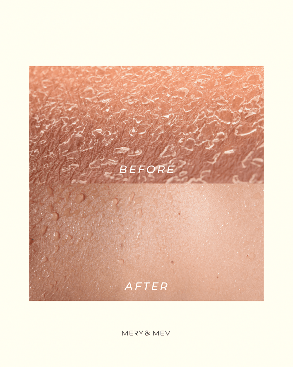 Body Exfoliating Gloves 2PC - www.Shopthatapp.com