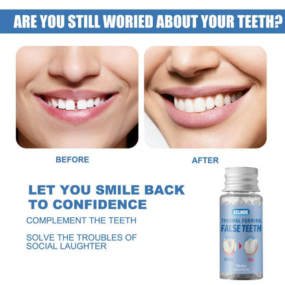 Easy-to-use Tooth Shaping Glue Video Beauty Denture Correction Temporary Filling - www.Shopthatapp.com