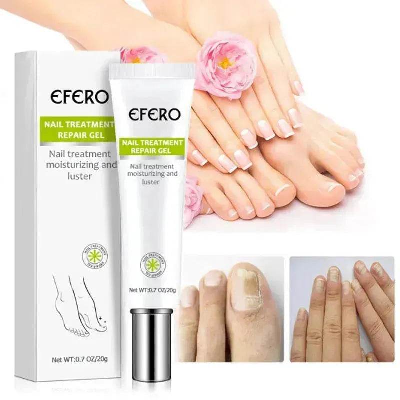 Nail Treatment Serum Nail Foot Nail Fungus Removal Gel Anti Infection Onychomycosis Nail Repair Cream Feet Care - www.Shopthatapp.com
