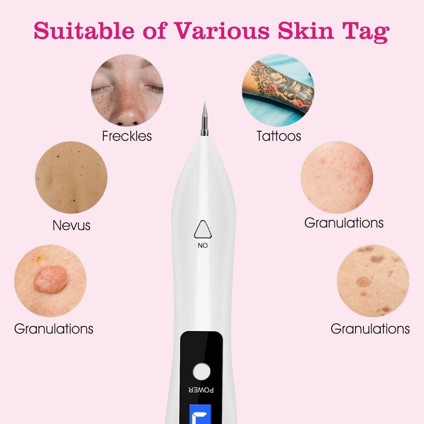 Skin Tag Repair Kit Portable Beauty Equipment Multi-Level With Home Usage USB Charging LCD Level Adjustable 6 Replaceable Needles - www.Shopthatapp.com