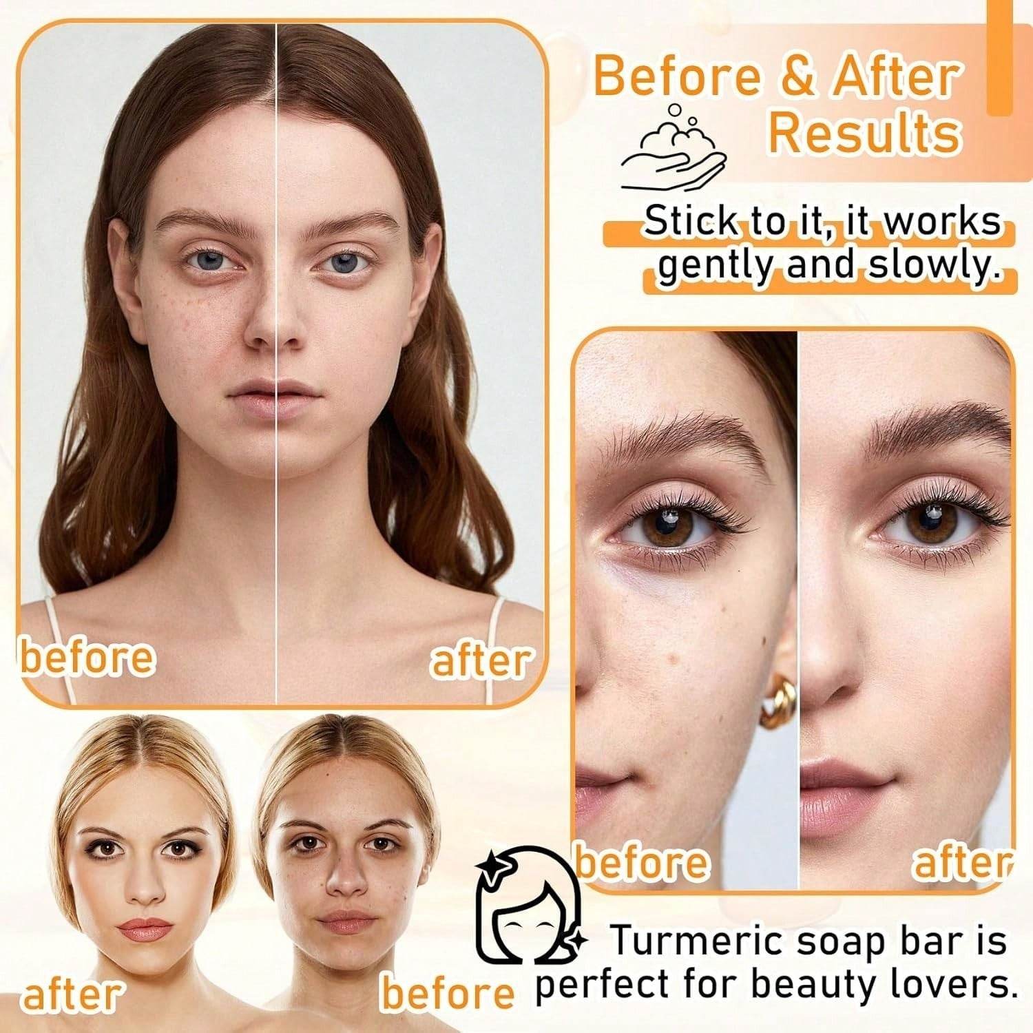 Body Face Brightening Turmeric Hyperpigmentation Bar Soap - www.Shopthatapp.com