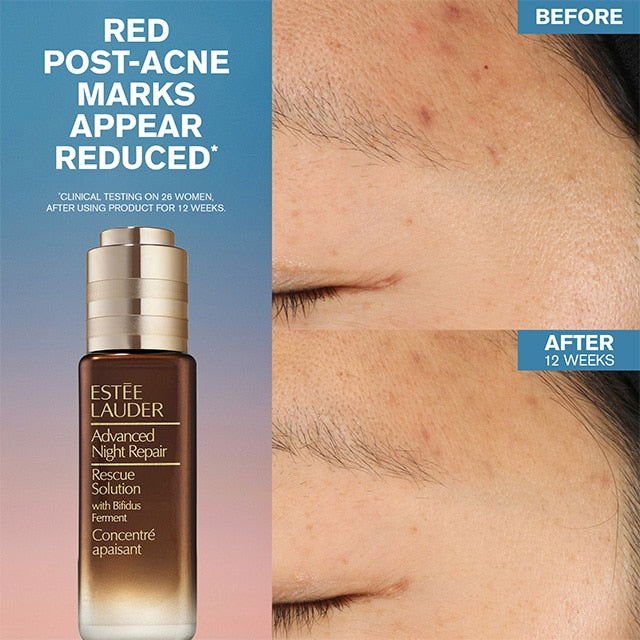 Advanced Night Repair Rescue Solution Serum with 15% Bifidus Ferment - www.Shopthatapp.com