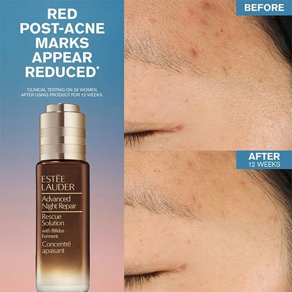 Advanced Night Repair Rescue Solution Serum with 15% Bifidus Ferment - www.Shopthatapp.com