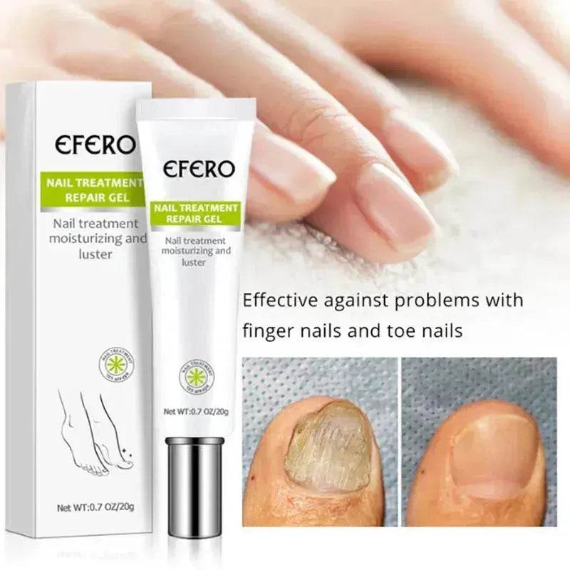 Nail Treatment Serum Nail Foot Nail Fungus Removal Gel Anti Infection Onychomycosis Nail Repair Cream Feet Care - www.Shopthatapp.com