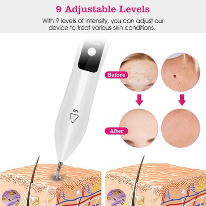 Skin Tag Repair Kit Portable Beauty Equipment Multi-Level With Home Usage USB Charging LCD Level Adjustable 6 Replaceable Needles - www.Shopthatapp.com